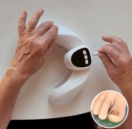 ピルズフリープロレーザー